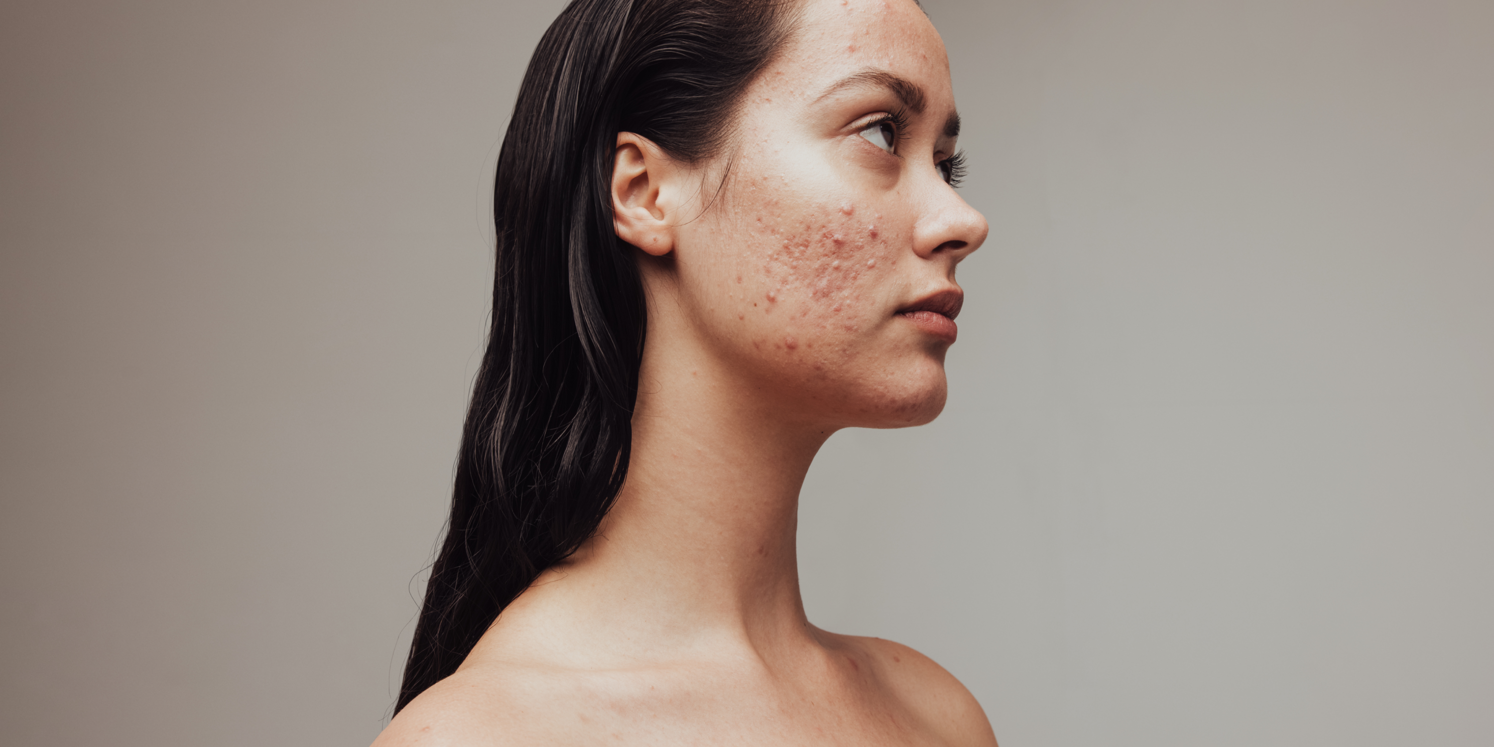 Colostrum for skin and hair health